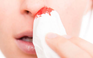 Прижигание кровоточащего сосуда в полости носа: как проводится