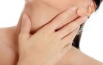 Воспаление лимфоузлов на шее — симптомы, причины, признаки, лечение