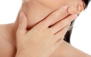 Воспаление лимфоузлов на шее — симптомы, причины, признаки, лечение