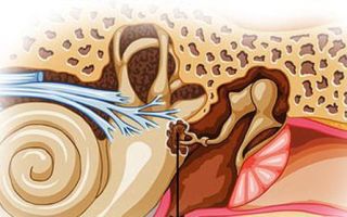 Болезни уха — причины, симптомы и лечение заболеваний ЛОР-органов