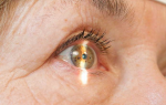 Аллергодил глазные капли: инструкция, цена, аналоги, отзывы