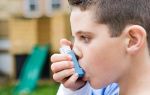 Аллергический кашель у ребенка: симптомы, профилактика заболевания