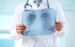 Что показывает рентген: преимущества методики и особенности процедуры