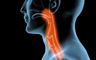 Как и чем лечить ожог горла и гортани: причины и симптомы заболевания