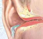 Воспалительные заболевания ушной раковины и наружного слухового прохода