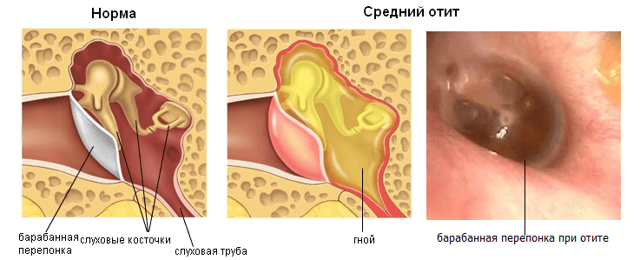 Где находится козелок уха: боль, воспаление, лечение и симптомы