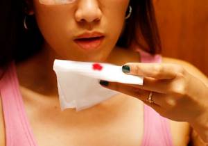 Из носа в горло течет кровь: причины и симптомы