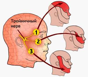 Воспаление тройничного нерва - признаки, симптомы и лечение