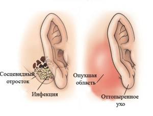 Болезни уха - причины, симптомы и лечение