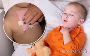 Компресс от кашля ребенку, как правильно проводить лечение
