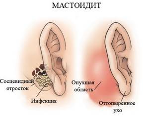 Строение и функции наружного уха: возможные заболевания органа