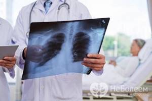 Как долго лечится пневмония у взрослых, диагностика заболевания