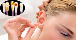 Ушная сера расскажет все о Вашем здоровье - основная функция ушной серы человека