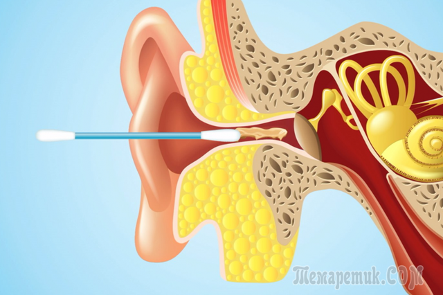Ушная сера расскажет все о Вашем здоровье - основная функция ушной серы человека