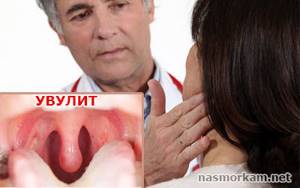 Язычок в горле - как называется и для чего он нужен, увулит симптомы и лечение