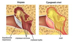 Боли в ушной раковине - причины боли, профилактические меры, терапия