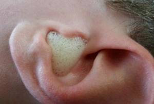 Перекись водорода как развести для носа: промывание, закапывание