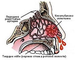 Из носа в горло течет кровь: причины и симптомы