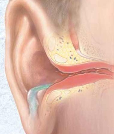 Лечение отомикоза уха. Симптомы, фото и диагностика ушного грибка