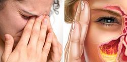 Жжение в носу - причины, диагностика и методы лечения