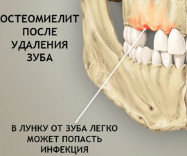 Болит скула и челюсть возле уха справа или слева больно жевать, отдает в ухо - лечение