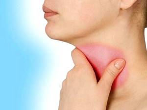 Симптомы и признаки рака горла - факторы риска и предраковые изменения