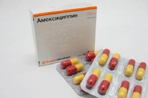 Амоксициллин - эффективное лекартво при лечении ангины