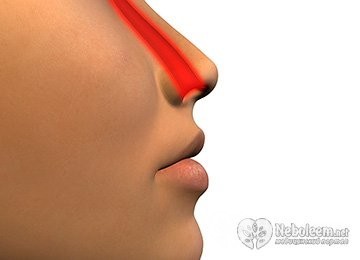 Причины появления боли в носу: диагностика и лечение