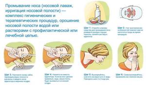 Мазь Симановского от гайморита для лечения носа: применение
