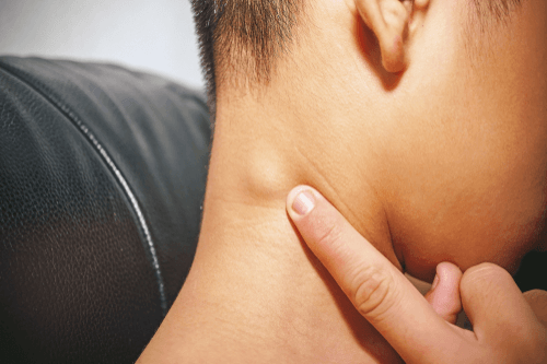 Рак лимфоузлов на шее: описание и особенности онкологии