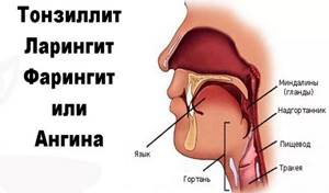Леденцы от боли в горле: список эффективных леденцов