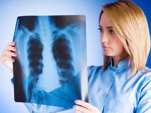 Очаговая пневмония - причины, симптомы, диагностика и лечение