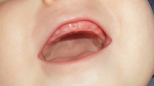 Кашель при прорезывании зубов у детей: причины и симптомы