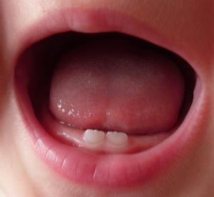Кашель при прорезывании зубов у детей: причины и симптомы