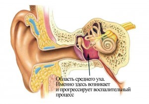 Как прогреть ухо в домашних условия, если оно болит и его заложило